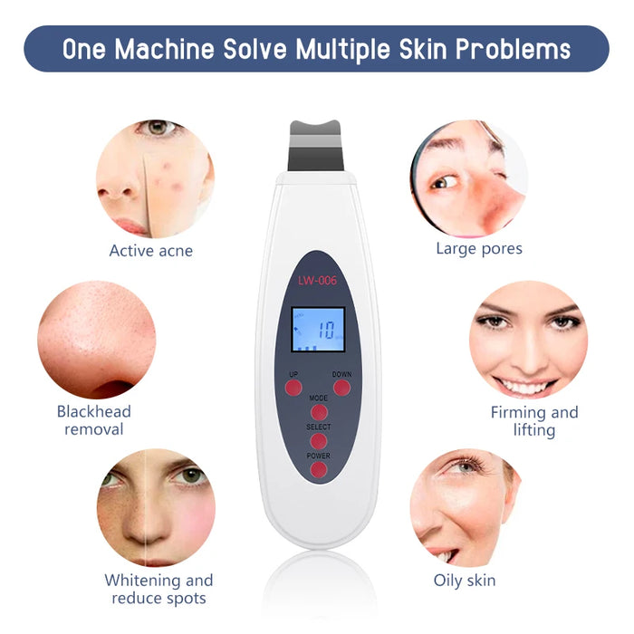 Ultrasonic skin scrubber facial deep cleansing machine to remove acne, exfoliating blackheads, facial massage and lifting LW006