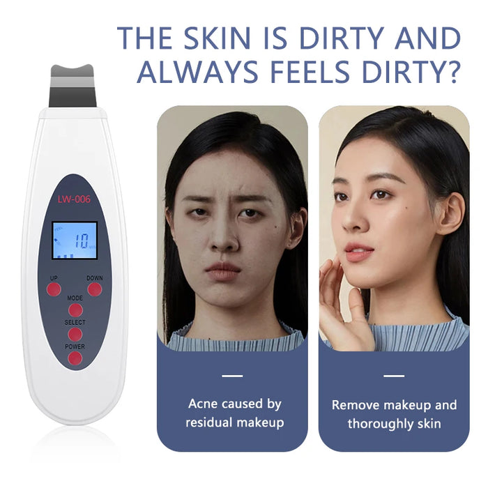 Ultrasonic skin scrubber facial deep cleansing machine to remove acne, exfoliating blackheads, facial massage and lifting LW006