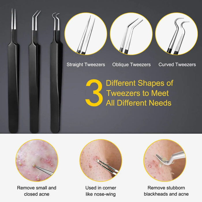 10Pcs Acne Blackhead Removal Needles Black Dots Cleaner Comedone Extractor Kit Deep Cleansing Tool Face Nose Skin Care Tools