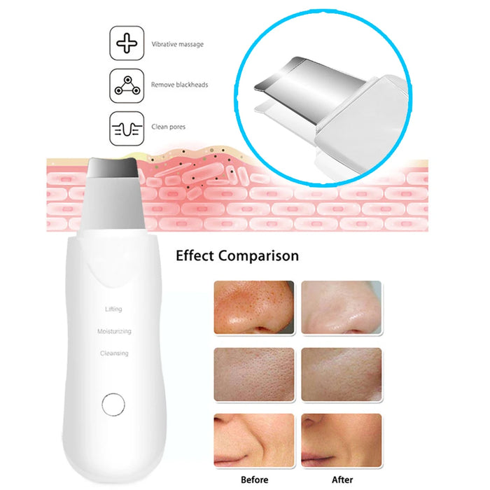 Ultrasonic Skin Scrubber Scrubber Deep Vibrate Facial Cleaner Shovel Face Scrubber Peeling Black Head Remover Facial Massager