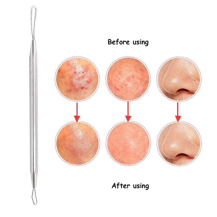 BlackHead Remover Tool Black Head Acne Blemish Pimple Extractor Acne Needles Tweezer Pore Cleaner Face Cleansing Tools Skin Care