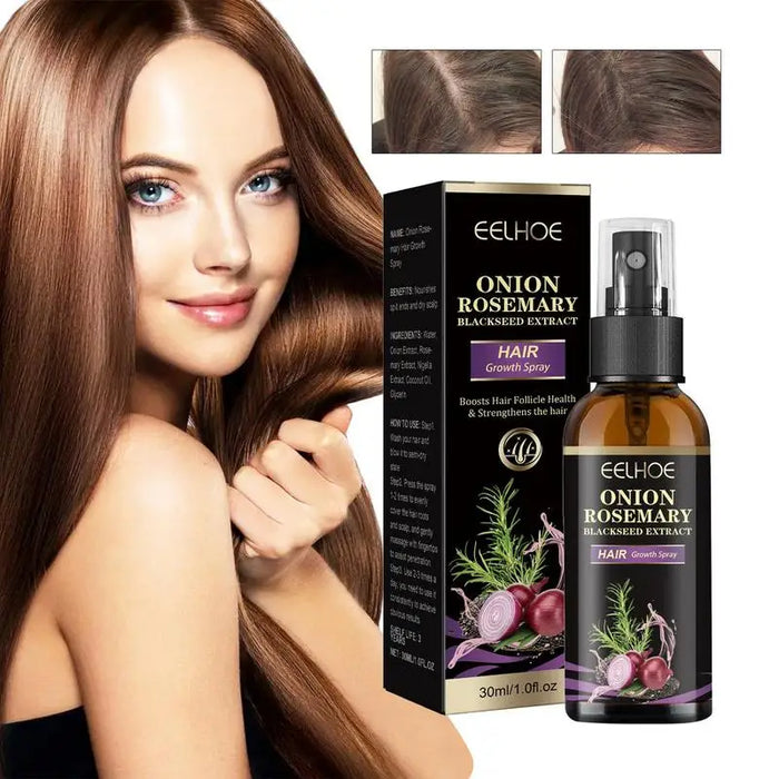 30ml Hair Growth Spray Onion Rosemary Dense Hair Spray Rosemary Essential Oil Hair Nourishing Essential Oil Anti Hair Loss Spray