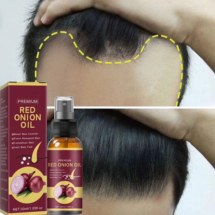 Powerful Hair Growth Serum Spray Repair Hair Nourish Root Regrowth Hair Anti Hair Loss Treatment Essence For Men Women Hair Care