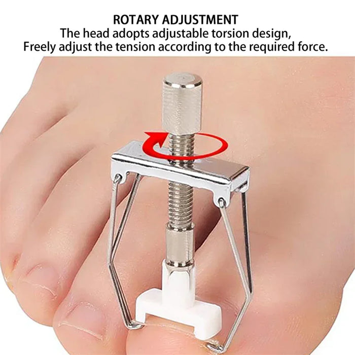 Ingrown Toenail Corrector Straightening Clip Pedicure Foot Nail Care Tools Stainless Steel Pedicure Treatment Onyxis Correction