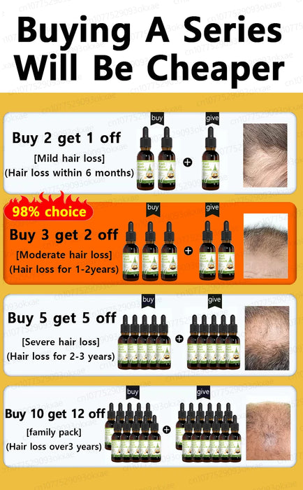 Hair growth products to quickly repair hair loss, hereditary hair loss, seborrheic alopecia