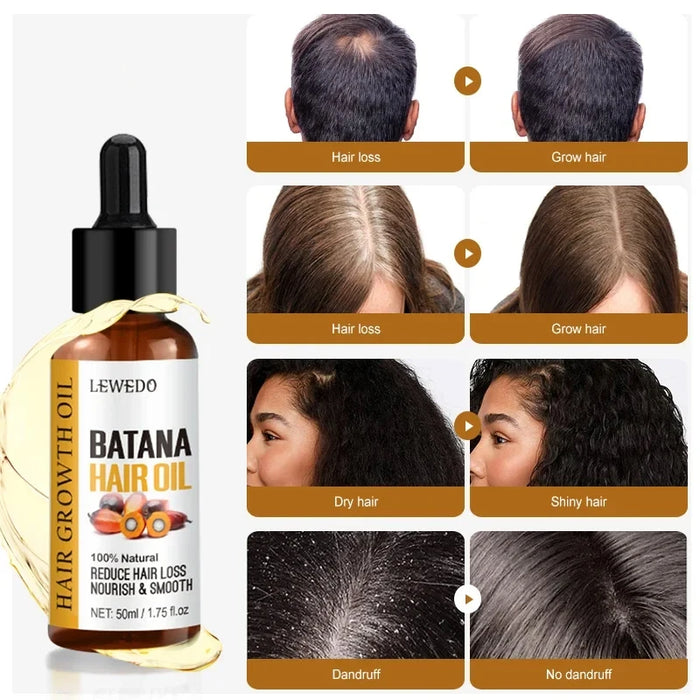 Natural 100% Batana Oil For Healthy Hair Treatment Oil Natural Promotes Hair Wellness For Men Women Enhances Anti Hair Break