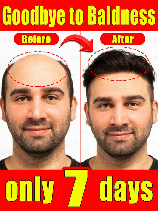 Hair growth products to quickly repair hair loss, hereditary hair loss, seborrheic alopecia