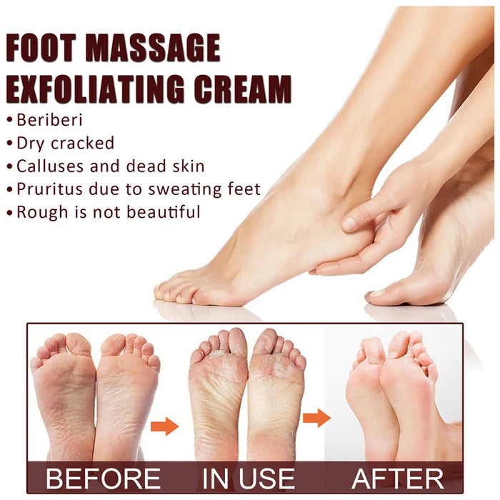 Anti Drying Feet Cream Heel Cracking Repair Products Exfoliation Dead Skin Removal Softening Moisturizing Hands Legs Care Beauty