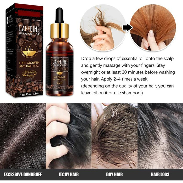 Alopecia Hair Treatment for Women Hairloss Hair Oil Growth Tool Spray Caffeine for Treatment Dry Frizzy Damaged Thin Hair Care