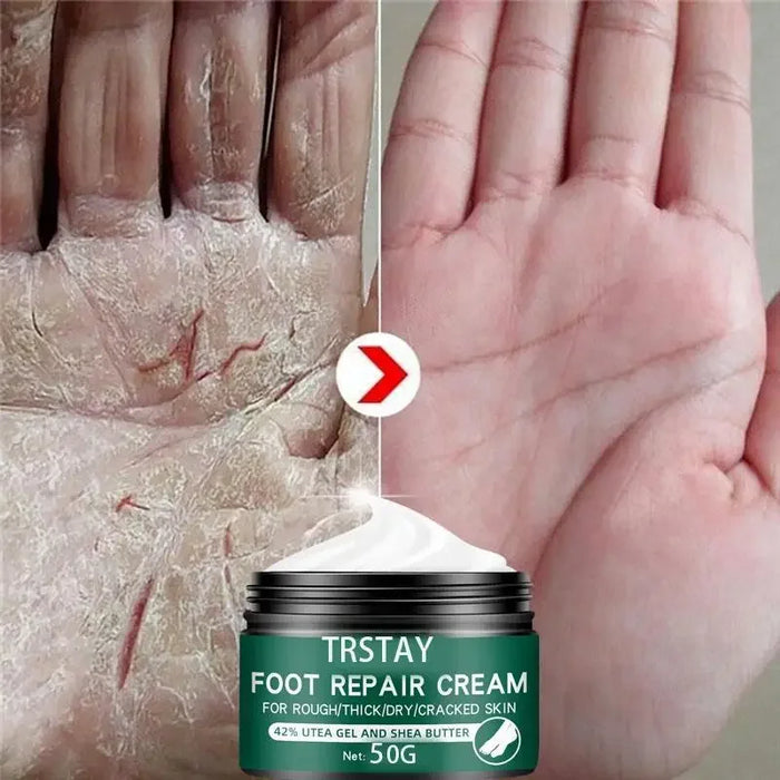 Size Upgrade Oil Anti-Drying Crack Foot Cream Heel Cracked Moisturizing Repair Cream Removal Dead Skin Hand Feet Care