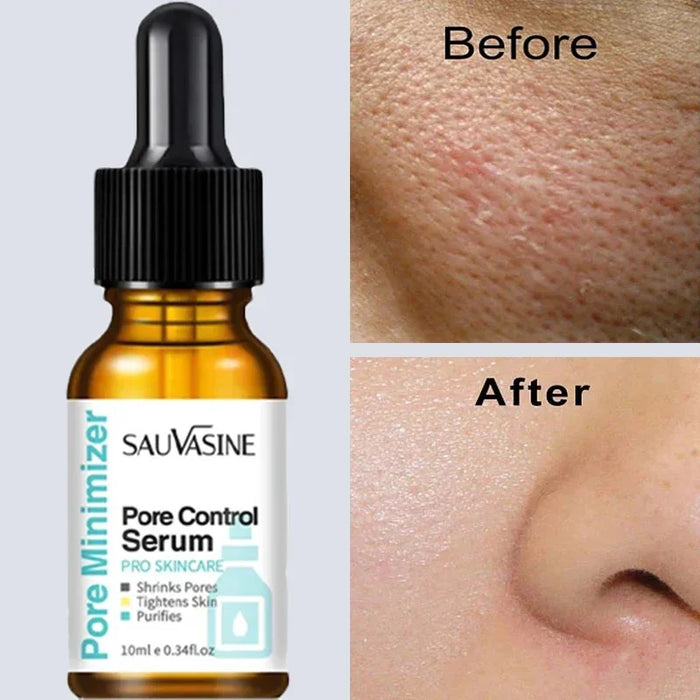 Removing Large Pores Pore Shrinking Serum Face Tightening Repairing Facial Pore Minimizing Moisturizing Skin Care Beauty Improve