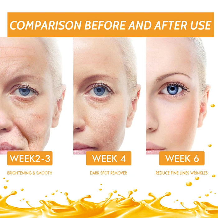 Vitamin C Whitening Serum Face Remove Dark Spots Freckles Fade Melanin Retinol Anti-wrinkle Essence Brightening Korean Skincare