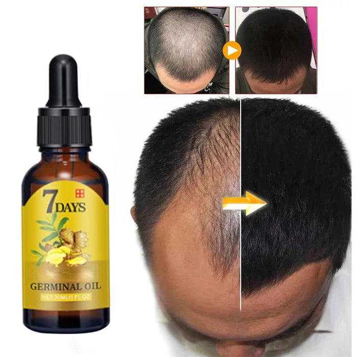 Fast Hair Growth Men Women Ginger Growth Hair Oil Treatment Anti Hair Loss Scalp Treatment Serum Products Beauty Healthwholesale