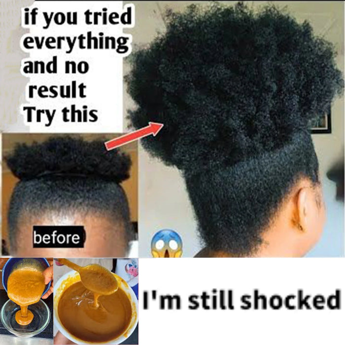 Africa Crazy Growth Oil Only 10-30 ml GROW YOUR HAIR FASTER LONGER IN TWO WEEKS