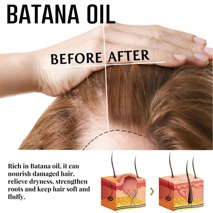 NEW Natural Pure Batana Oil For Hair Growth Batana Oil Butter From Honduras Hair Loss Treatments For Men & Women hair care