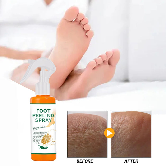 100ml Foot Peeling Spray Orange Essential Oil Exfoliating Peel Dead Skin Remover