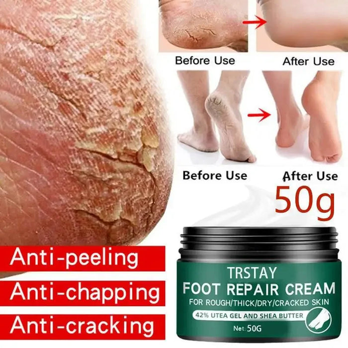 Size Upgrade Oil Anti-Drying Crack Foot Cream Heel Cracked Moisturizing Repair Cream Removal Dead Skin Hand Feet Care