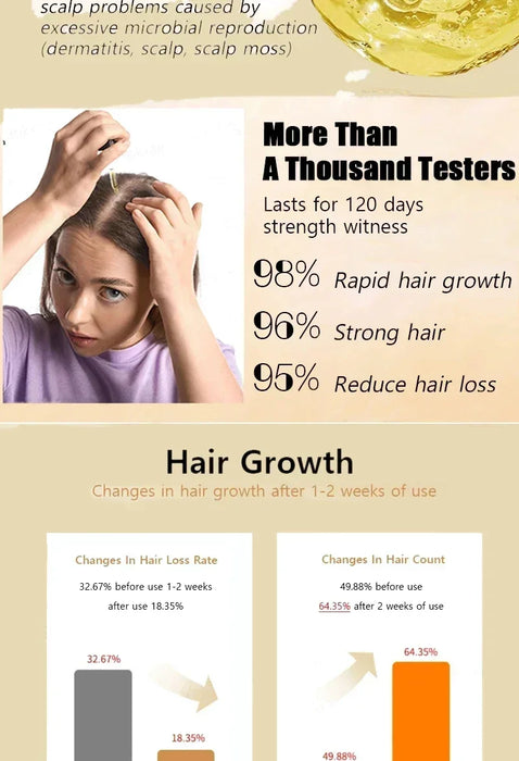 Fast Hair Growth Hair Growth Oil Effective Baldness Repair Hereditary Loss Postpartum  Loss Seborrheic Hair Anti Loss