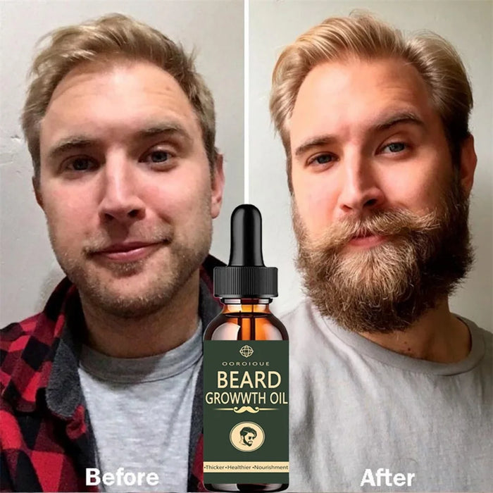 Fast Beard Growth Oil Beard Oil for Men Caffeine Natural Beard Growth Serum Promote Hair Regrowth Professional Brazilian Keratin