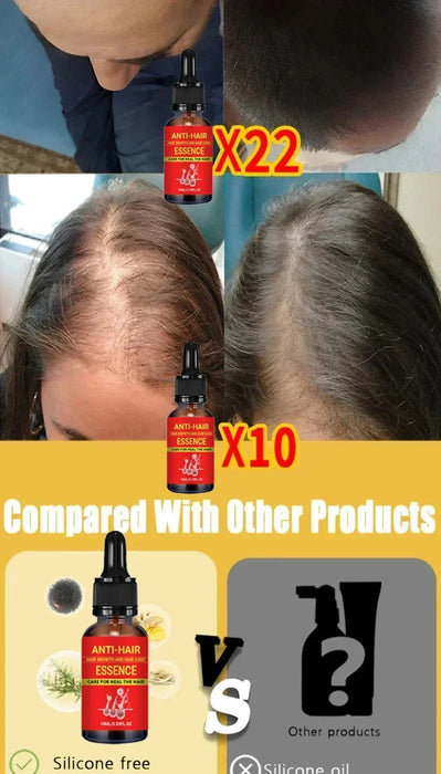 Fast Hair Growth Hair Growth Oil Effective Baldness Repair Hereditary Loss Postpartum  Loss Seborrheic Hair Anti Loss