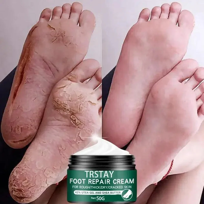 Size Upgrade Oil Anti-Drying Crack Foot Cream Heel Cracked Moisturizing Repair Cream Removal Dead Skin Hand Feet Care