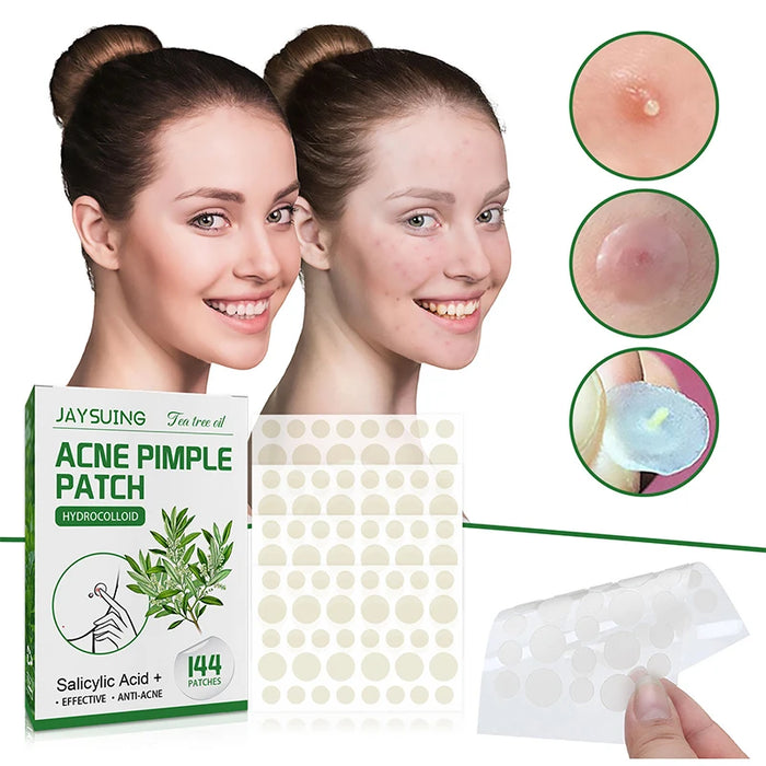 144Pcs Acne Pimple Patch Stickers Waterproof Acne Treatment Pimple Remover Tool Blemish Spot Facial Mask Skin Care