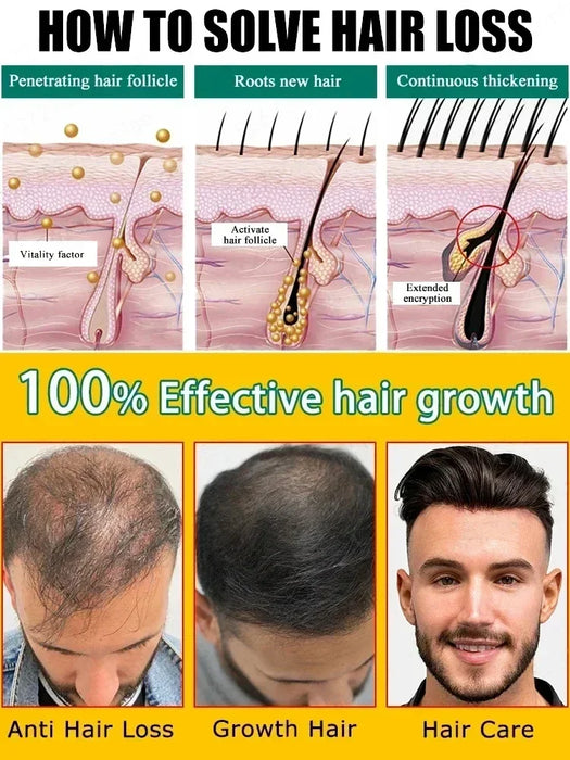 Fast Hair Growth Hair Growth Oil Effective Baldness Repair Hereditary Loss Postpartum  Loss Seborrheic Hair Anti Loss