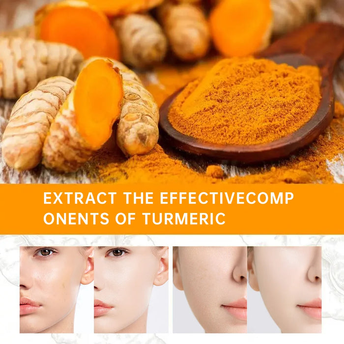 Turmeric Freckle Whitening Serum Anti-oxidant Nourishing Moisturizing Repair Skin Brighten Fade Dark Spot Essence Face Care