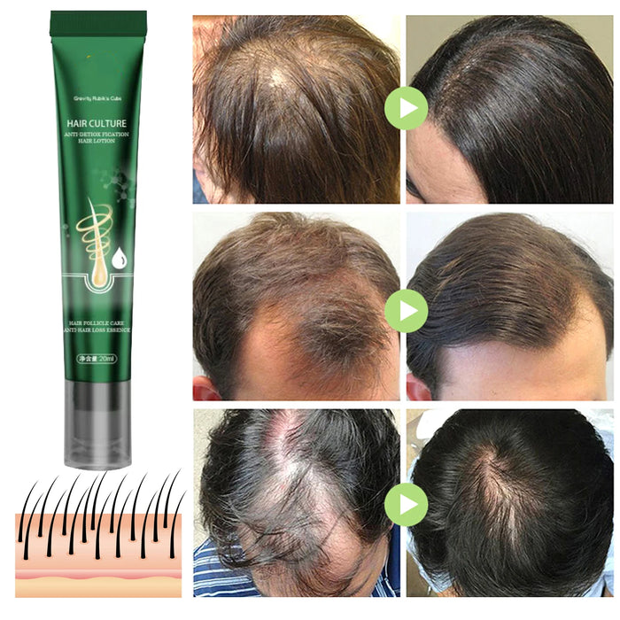 Hair Growth Oil Effective Baldness Repair Hereditary Postpartum Seborrheic Hair Loss for Women & Men Fast Hair Growth Oil