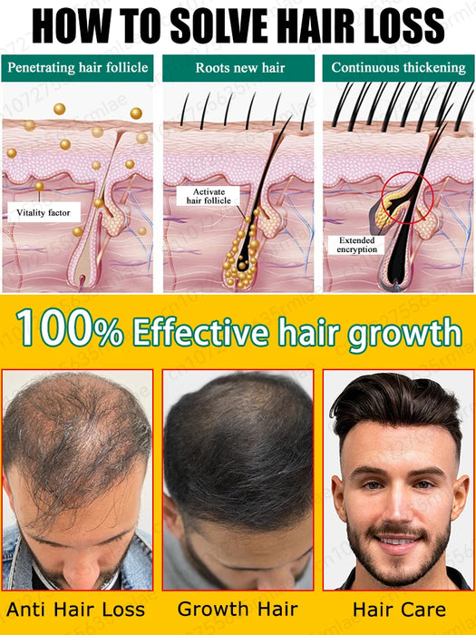 Hair growth essential oil for treating baldness