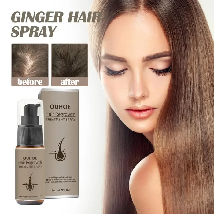 Fast Hair Growth Spray Products Anti Hair Loss Serum Prevent Baldness Treatment Scalp Dry Damaged Essential Oil Hair Beauty