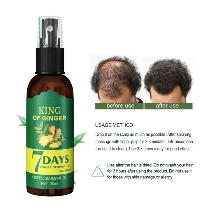 Ginger Hair Growth Spray Strengthening Hair Massage Scalp Dense Hair Strengthening Hair Loss Prevention Repair Nourishing Liquid