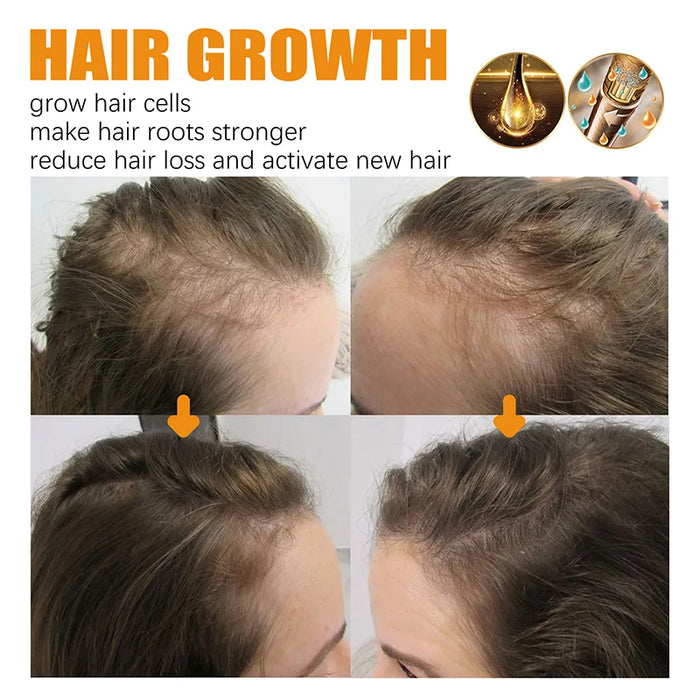 Fast Hair Growth Serum Spray Deep Cleansing Nourishing Scalp Anti Hair Fall Fixing Dense Hair Hairdressing Treatment Products