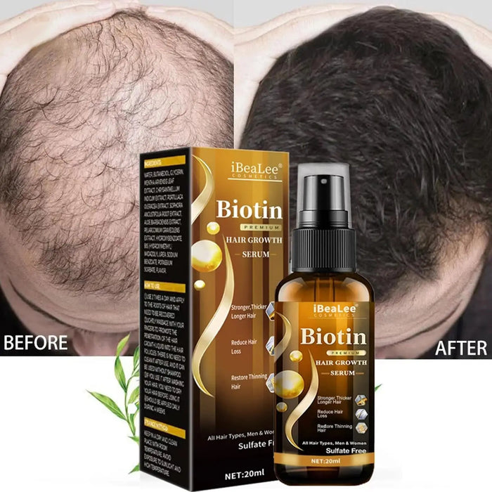 IBeaLee Biotin Anti Hair Loss Spray 1/2/3pcs Scalp Treatment Products Fast Growing Hair Care Essential Oils For Men