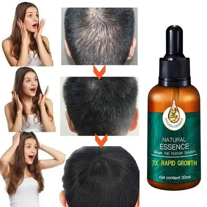 Hair Growth Essence Oil Hair Care Products Natural Herbal Fast Hair Growth Essence Moisturizing and Softening Hair Quality