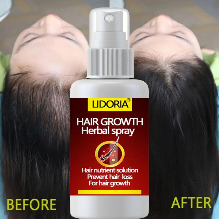 LIDORIA Hair Tonic Promote hair growth and nourish hair roots