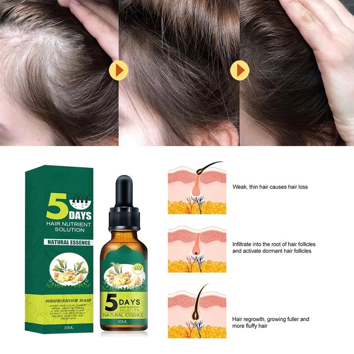 Anti Alopecia Fast Hair Growth Oil Ginger Essential Oil Hairless Baldhead High Hairline Increase Cream Head Essence