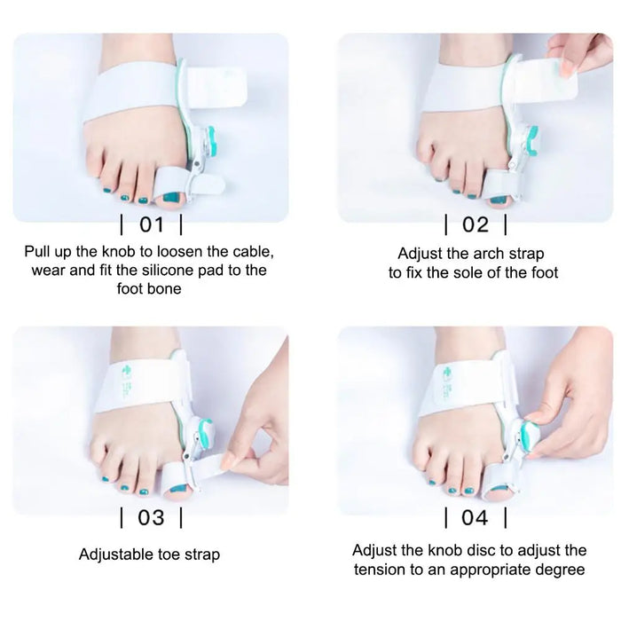 New Bunion Splint Big Toe Straightener Adjustable Corrector Knob Hallux Valgus Correction Orthopedic Supplies Pedicure Foot Care