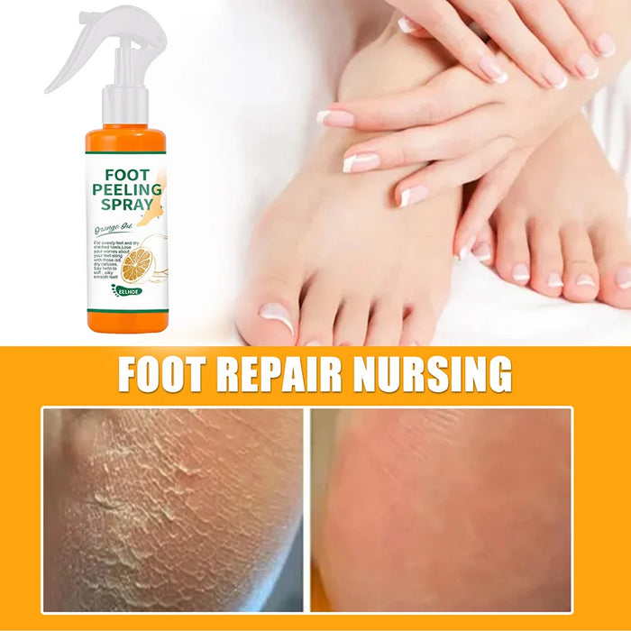 100ml Foot Peeling Spray Orange Essential Oil Exfoliating Peel Dead Skin Remover