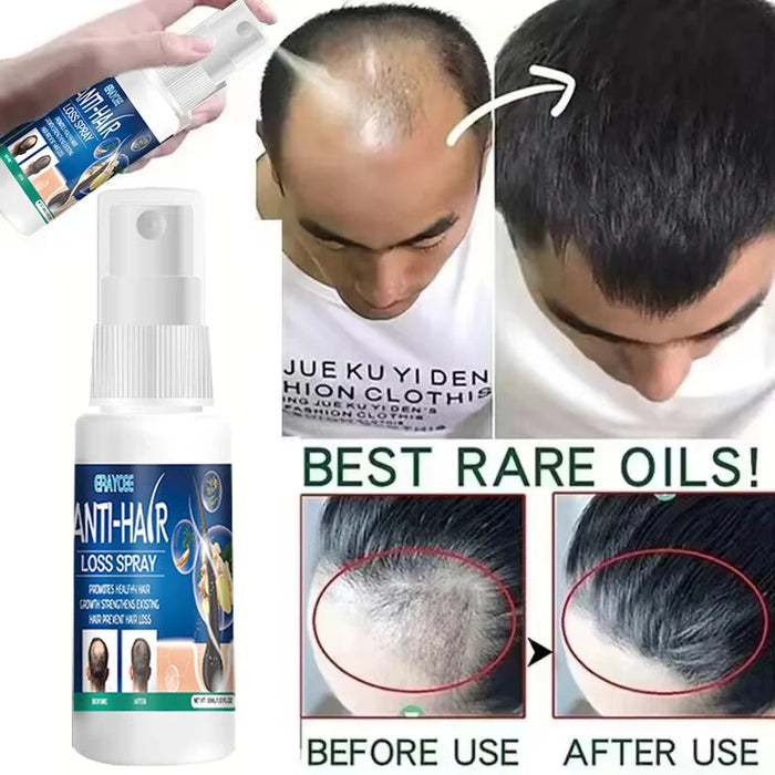 Powerful Hair Growth Serum Spray Ginger Anti Loss Treatment Products Men Women Fast Regrowth Loss Postpartum