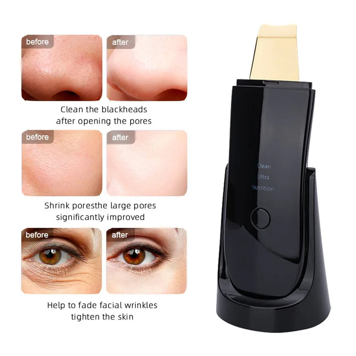 Lesen Ultrasonic Face Cleaner Skin Scrubber Ultrasound Vibration Lifting Massager Ultrasound Peeling Clean Tone Lift Scrubber