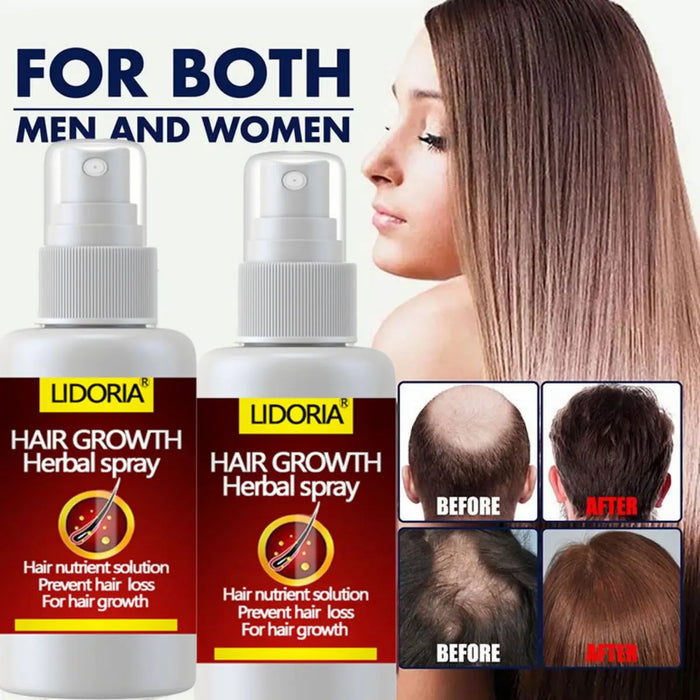 LIDORIA Hair Tonic Promote hair growth and nourish hair roots