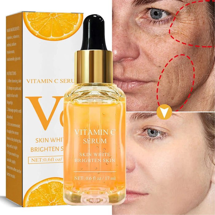 Vitamin C Whitening Serum Face Remove Dark Spots Freckles Fade Melanin Retinol Anti-wrinkle Essence Brightening Korean Skincare