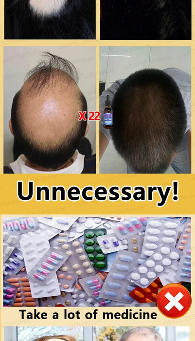 Unisex Growth Oil Hair Loss Treatment Rapid Hair Growth Effective Baldness Repair Hereditary Postpartum Hair Loss