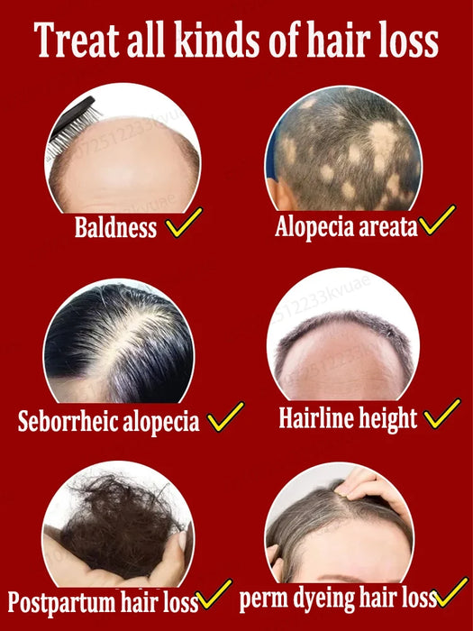 Hair growth essential oil for treating baldness