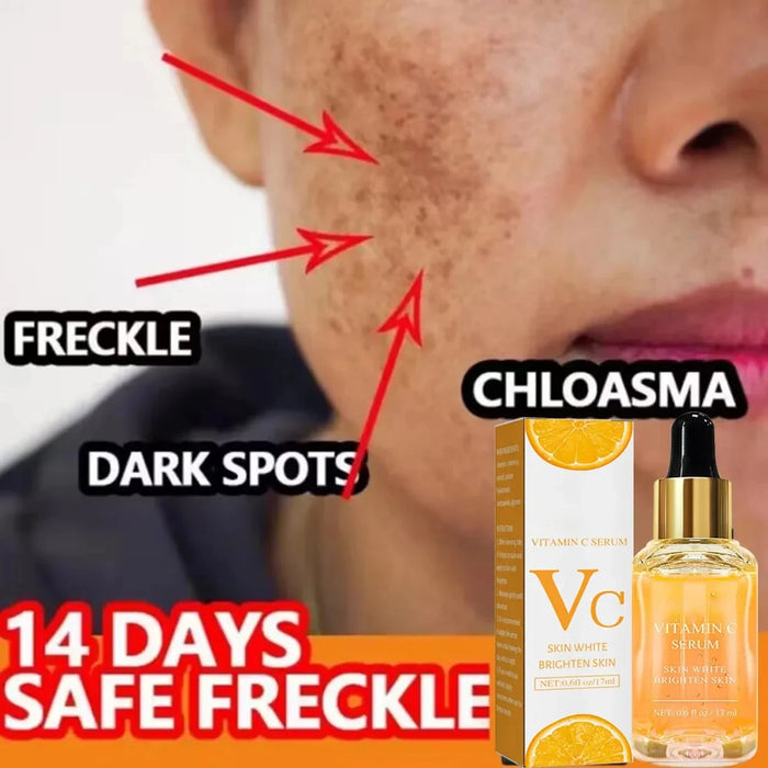 Vitamin C Whitening Serum Face Remove Dark Spots Freckles Fade Melanin Retinol Anti-wrinkle Essence Brightening Korean Skincare