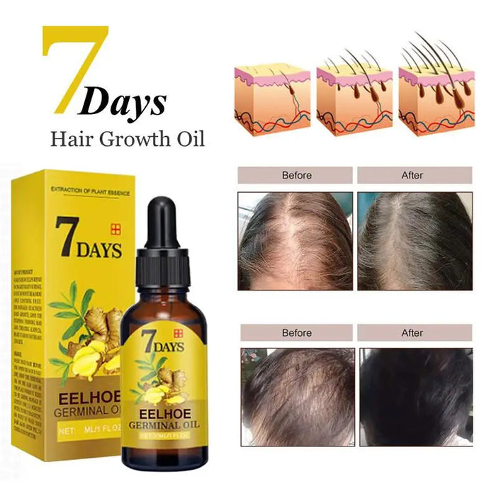 Ginger Fast Hair Growth Oil Anti Hair Loss Treatment for Man Women Serum Scalp Baldhead Repair Nourish Root Fast Growing Product