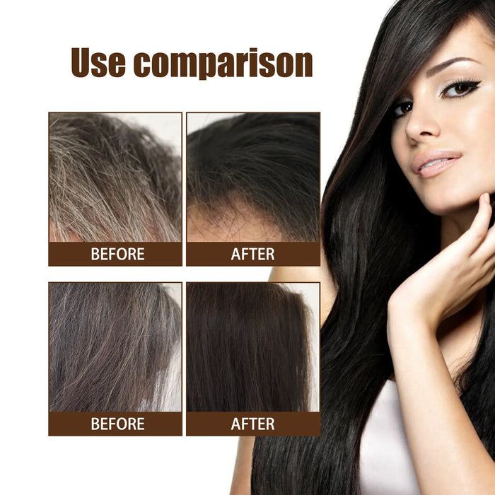 Lasting Anti Gray Hair Treatment Serum White to Black Hair Growth Natural Color Repair Nourish Men Women Anti Hair Loss Products