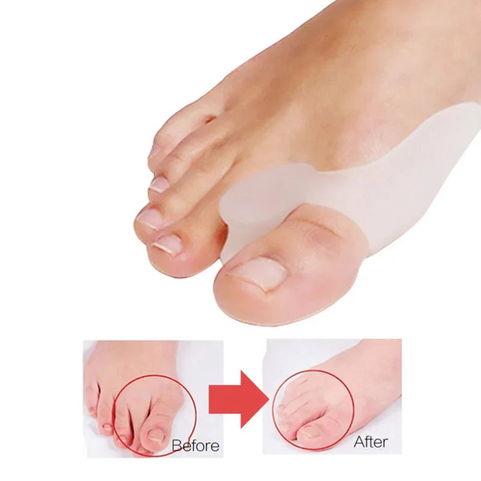 2Pcs=1Pair Silicone Toes Separator Bunion Bone Ectropion Adjuster Toes Outer Appliance Foot Care Tools Hallux Valgus Corrector