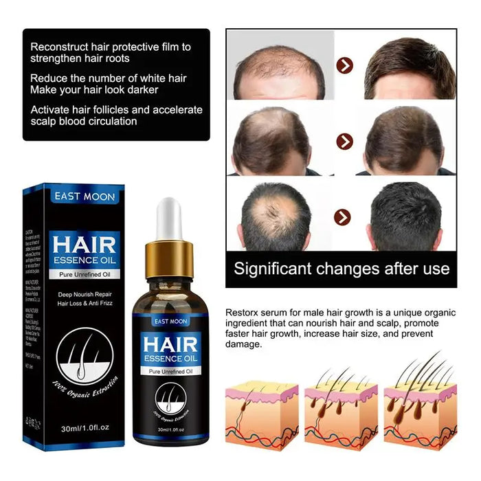 Hair Growth Oil Repair Hereditary Hair Loss Postpartum Hair Loss Follicle Seborrheic Hair Loss Fast Effective Repair Baldness